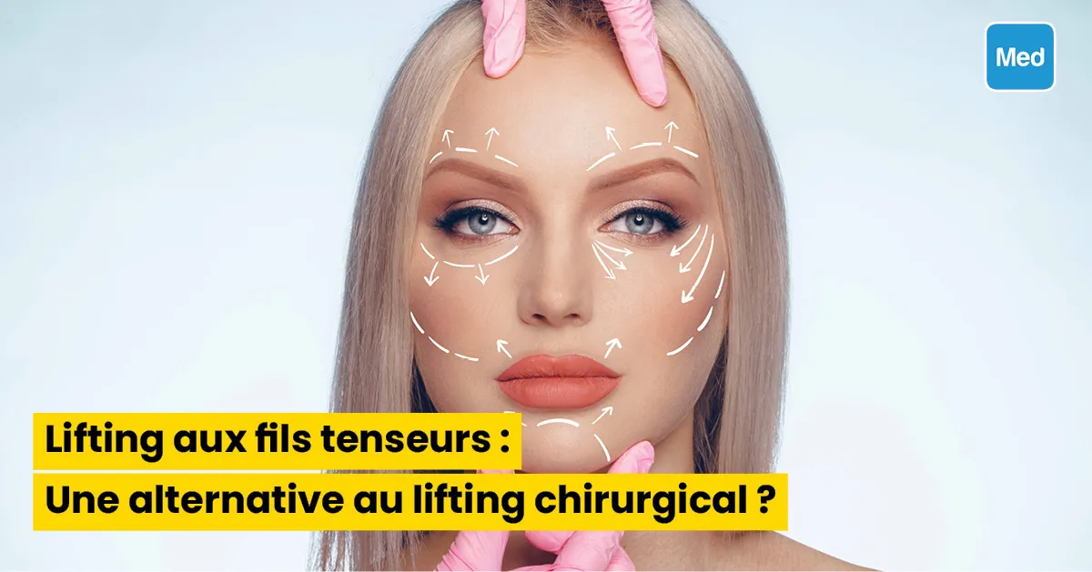 Lifting aux fils tenseurs : Une alternative au lifting chirurgical ?